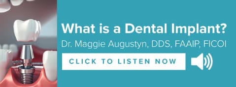 Listen: What is a Dental Implant?