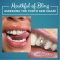 Mouthful of Bling: Assessing the Tooth Gem Craze (featured image)